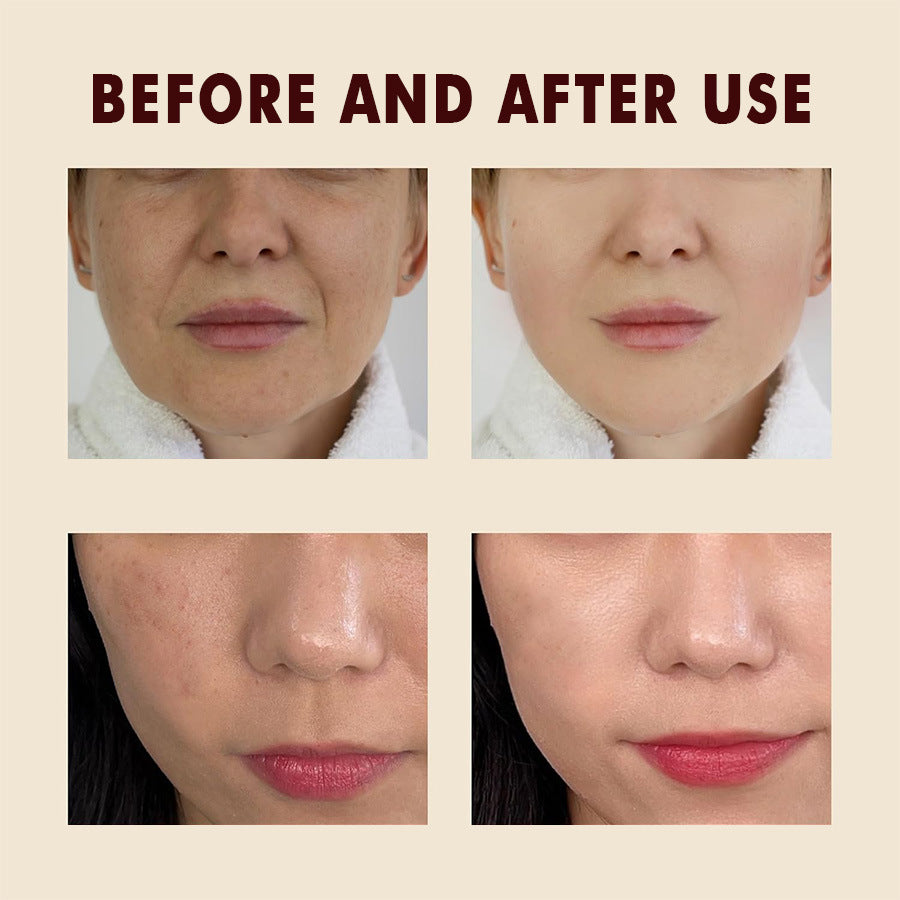 💖 Summer Must-Have! Soft Peel Ampoule – Dead Skin Be Gone! 🧼