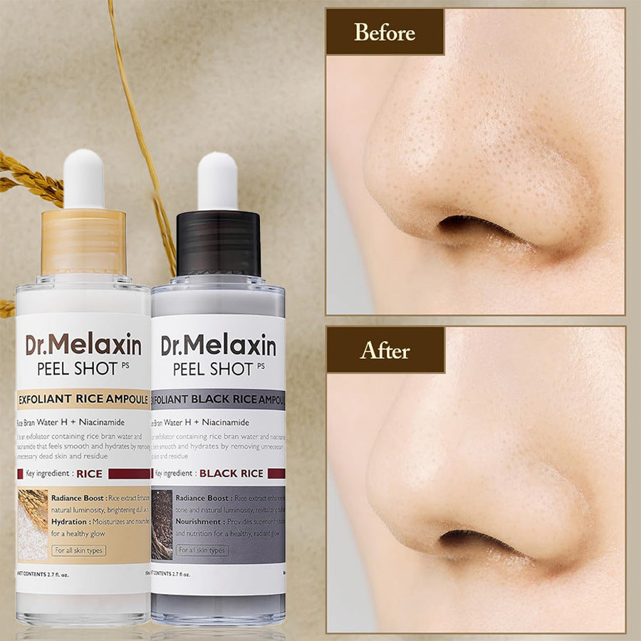 💖 Summer Must-Have! Soft Peel Ampoule – Dead Skin Be Gone! 🧼